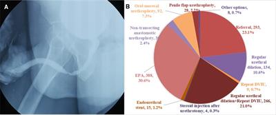The treatment practices for anterior urethral strictures in China: A case-based survey